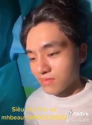 KHẮC PHỤC MŨI THẤP NAM GIỚI TẠI MH Beauty