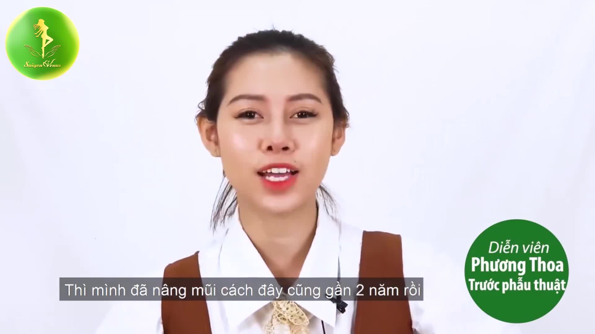NÓI ĐẾN TÁI PHẪU THUẬT MŨI HỎNG - BẠN NGHĨ ĐẾN AI DIỄN VIÊN PHƯƠNG THOA "CẦU CỨU" THẠC SĨ - BÁC SĨ NGUYỄN TIẾN HUY