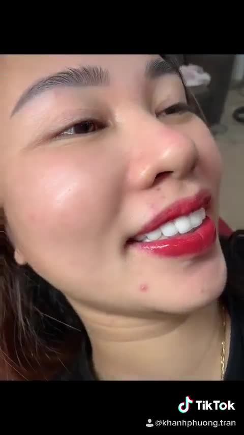 " Tự Ti " với hàm răng xấu " Ngại Ngùng " khi giao tiếp ? Muốn thay đổi nhưng còn e ngại