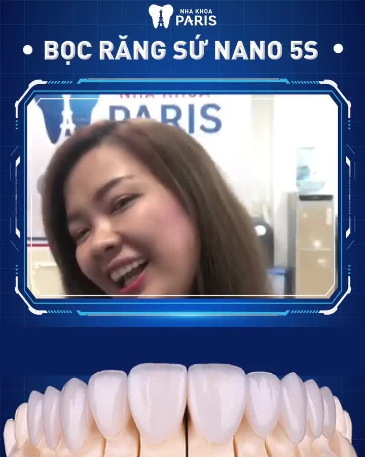 2 NGÀY BỌC SỨ -  Răng hết Thưa/ Hô/ Nhiễm màu...