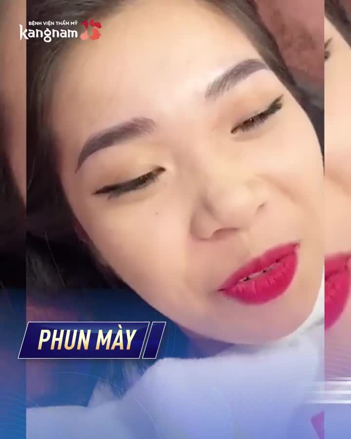 Môi thâm - Mày thưa - Mí không rõ