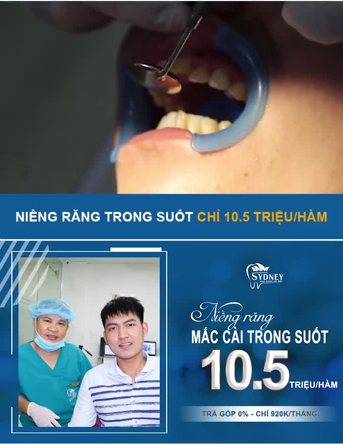 NIỀNG RĂNG TRONG SUỐT - LỰA CHỌN CỦA KHÁCH HÀNG