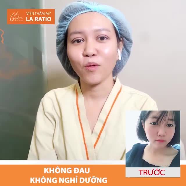 Chị khách hàng khẳng định cắt mí ilid tại La Ratio: Không những không đau mà còn rất là DỄ CHỊU