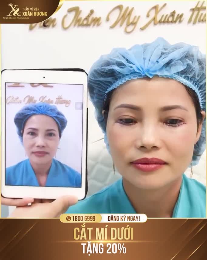 50 CHƯA PHẢI LÀ GIÀ - NẾU BẠN BIẾT "TUYỆT CHIÊU" ĐẢO NGƯỢC LÃO HÓA NÀY!