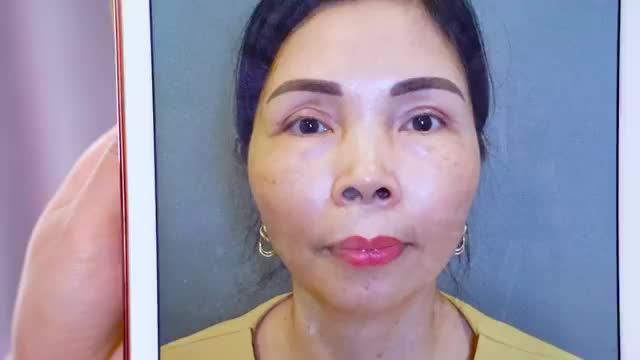 CÁC CA MÍ HỎNG ĐƯỢC GIẢI CỨU ĐẸP XUẤT SẮC NHƯ THẾ NÀO TẠI DR.HẢI LÊ - Mời khách hàng cùng theo dõi.!