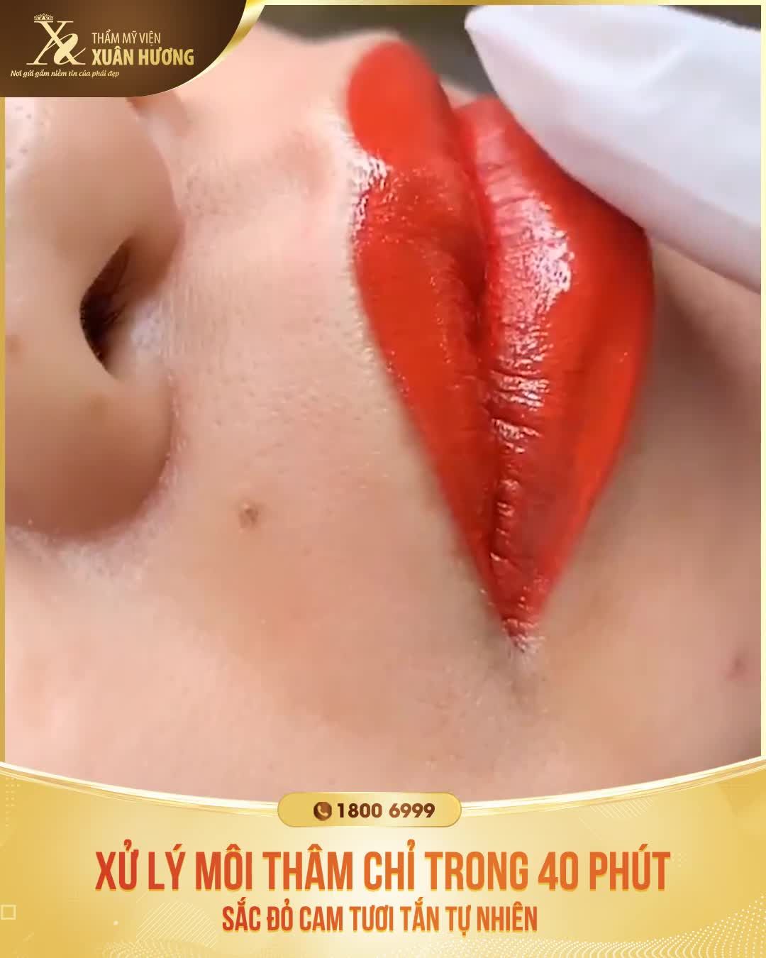 KHỬ MÔI THÂM CHƯA BAO GIỜ NHANH CHÓNG VÀ DỄ DÀNG ĐẾN THẾ