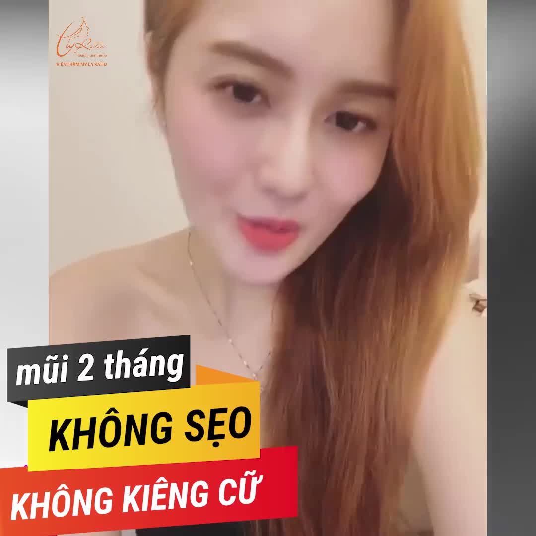 VIDEO KHÁCH HÀNG PHẢN HỒI MŨI MEGA S SAU KHI ĐƯỢC NÂNG 2 THÁNG