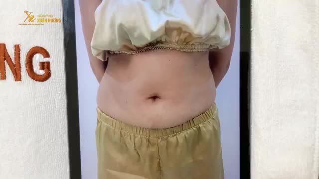 VÒNG 2 LỘ "RỔ MỠ" 3 NGẤN, VÁY ÁO FREESIZE MÀ VẪN CHẬT KHÁCH HÀNG CHỌN GIẢM B.É.O DETOX SLINE BODY TRÚT NGAY MỠ THỪA SAU BUỔI ĐẦU TIÊN