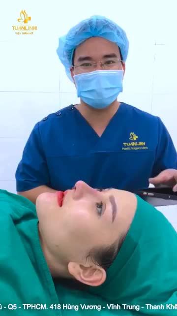 Combo Nâng mũi cấu trúc  mũi sửa lại  Độn cằm Vline - Khách hàng VTM Tuấn Linh.