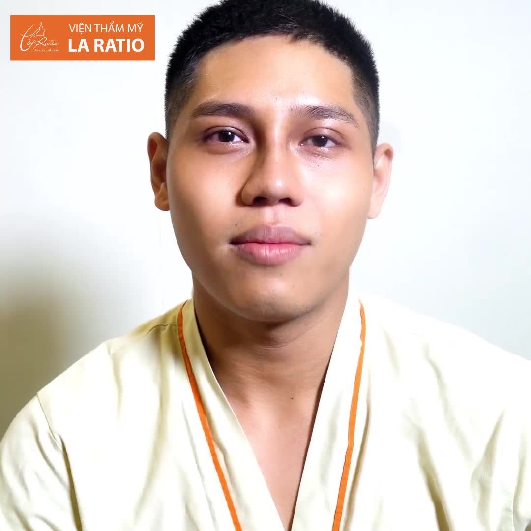 MŨI VỪA NÂNG VÀ MŨI SAU 7 NGÀY SẼ NHƯ THẾ NÀO