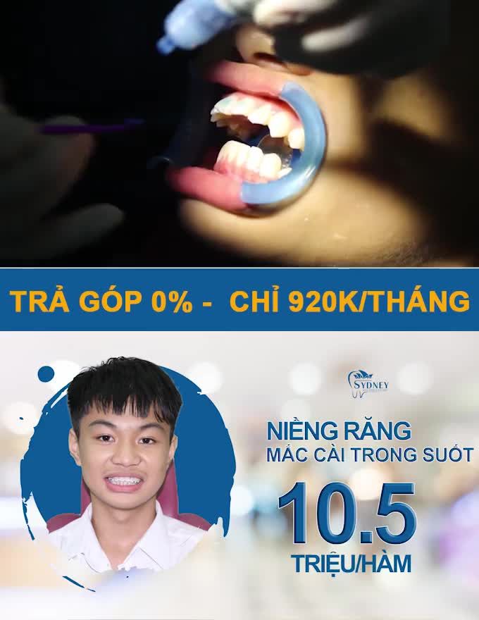 TẠI SAO PHA LÊ ĐƯỢC LỰA CHỌN NHIỀU HƠN SỨ