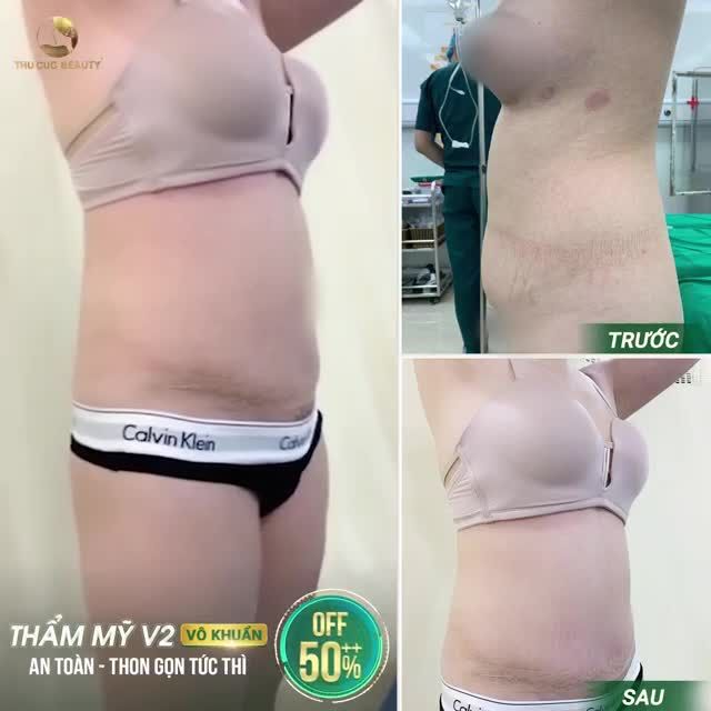 LOẠI BỎ 90% MỠ THỪA - EO THON CHỈ SAU 60'