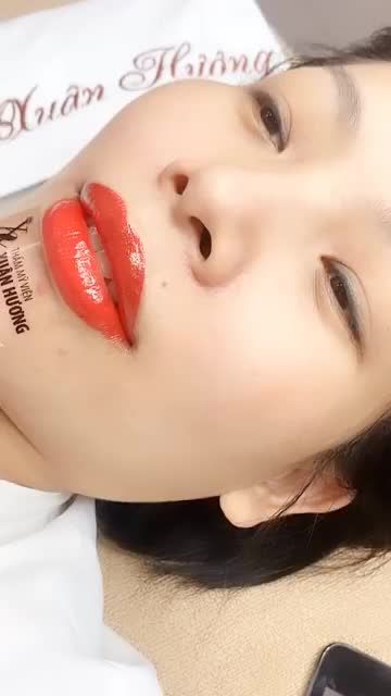 "MÃN NHÃN" VỚI KẾT QUẢ PHUN MÔI MIRACLE TẠI TMV XUÂN HƯƠNG