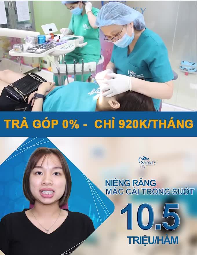 NIỀNG RĂNG CHỈ VỚI 10.5TR VẪN ĐẸP