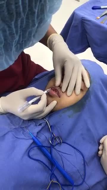 Biến hoá nụ cười quyến rũ cùng Combo Tạo môi tim+ Thu mỏng môi dưới cùng bác sĩ Kangnam