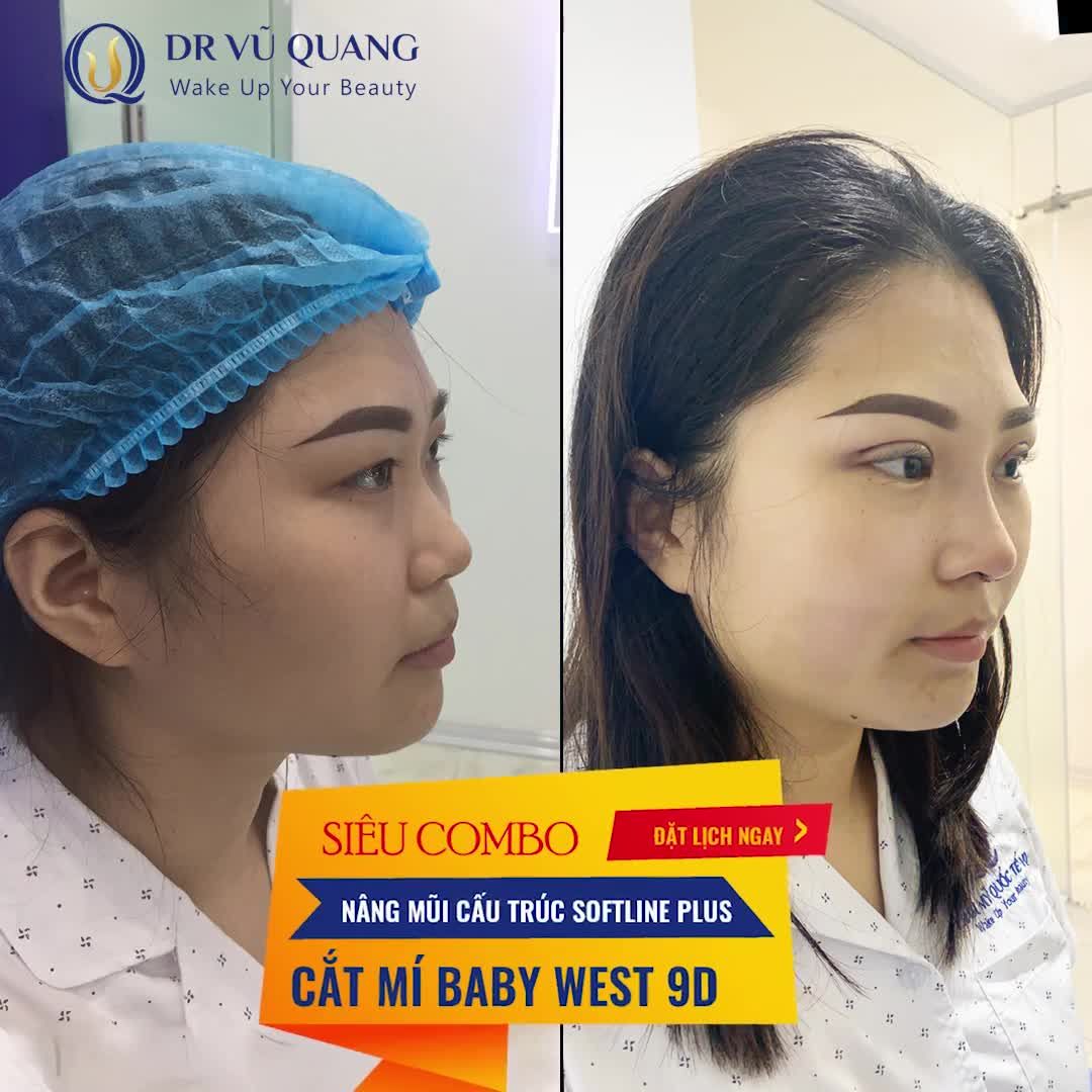 Không làm thì thôi, đã làm là phải làm combo