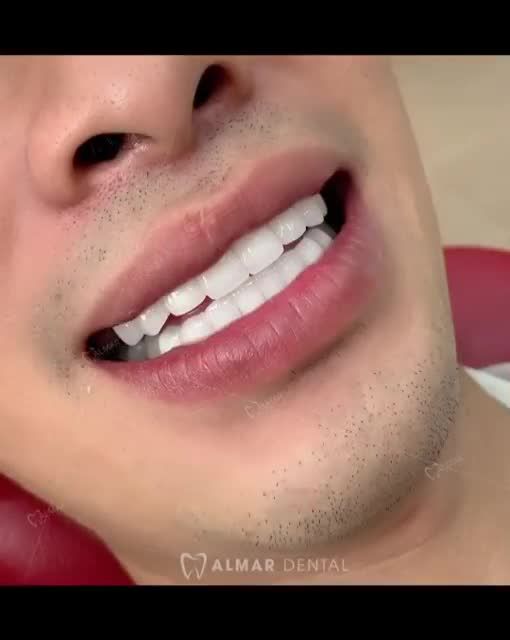 ĐÀN ÔNG HIỆN ĐẠI - CHẲNG NGẠI LÀM RĂNG