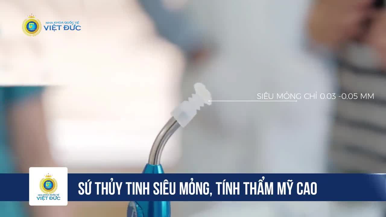 DÁN SỨ VENEER BẢO TỒN 100% RĂNG THẬT, KHẮC PHỤC MỌI TRƯỜNG HỢP RĂNG XẤU