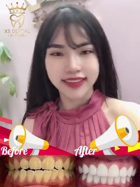 KHI BẠN CÒN CHẦN CHỪ THÌ NGƯỜI KHÁC ĐÃ ĐẸP