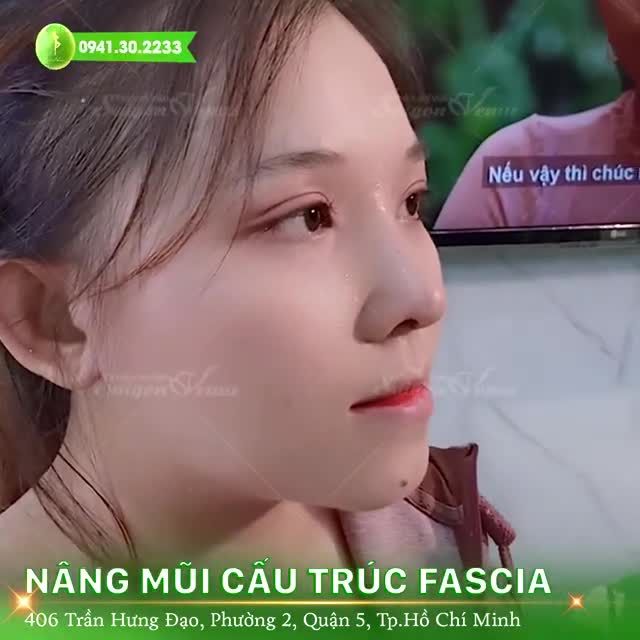 TRẢI NGHIỆM CÔNG NGHỆ ĐI ĐẦU TRONG NÂNG MŨI