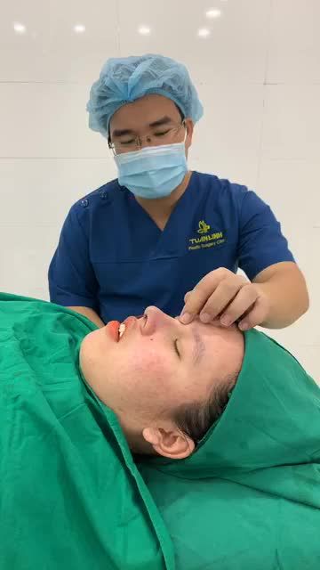 Nâng mũi cấu trúc dáng mũi Angel line  tại Tuấn Linh sau 60p Phẫu thuật của một khách hàng đến từ Q12