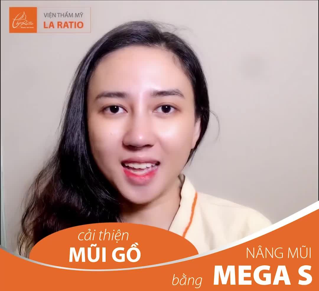 NÂNG MŨI MEGA S CHỈNH SỬA MŨI GỒ - KHÔNG ĐAU – KHÔNG BẦM