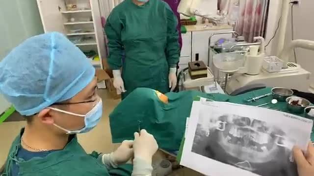 cấy 3 cây Implant phục hình răng hàm đã mất