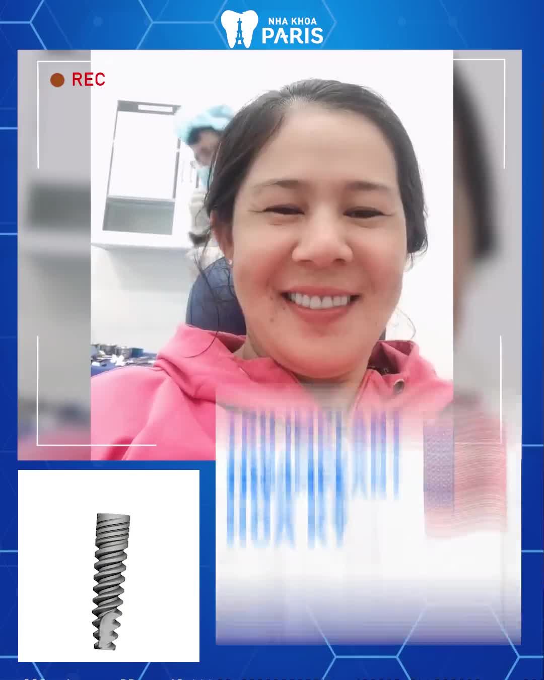 TRỒNG RĂNG IMPLANT - BẢO HÀNH TRỌN ĐỜI