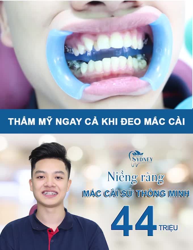 CÓ THỂ BẠN CHƯA BIẾT ƯU ĐIỂM NÀY CỦA MẮC CÀI THÔNG MINH