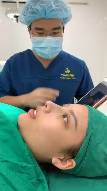 Khách hàng nâng mũi cấu trúc Surgiform