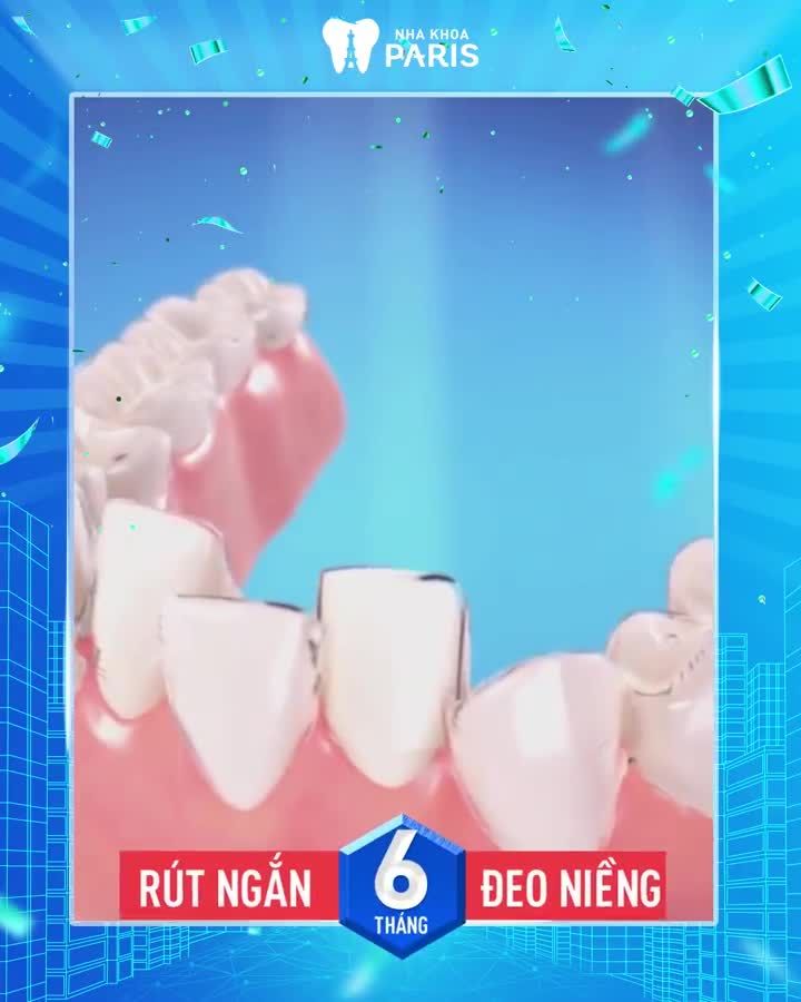 NIỀNG RĂNG VÔ HÌNH KHÔNG AI BIẾT - THẨM MỸ TUYỆT ĐỐI