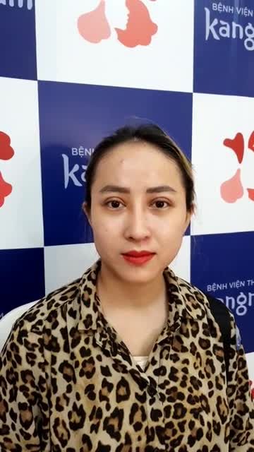 Sau 1 tháng khách Nâng mũi + Cắt mí + Trượt cằm nhìn mê ly luôn cả nhà ơi