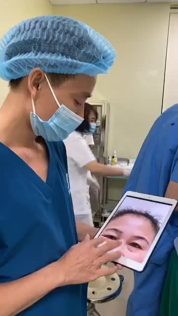 CẮT MÍ TRÊN - CẮT MÍ DƯỚI