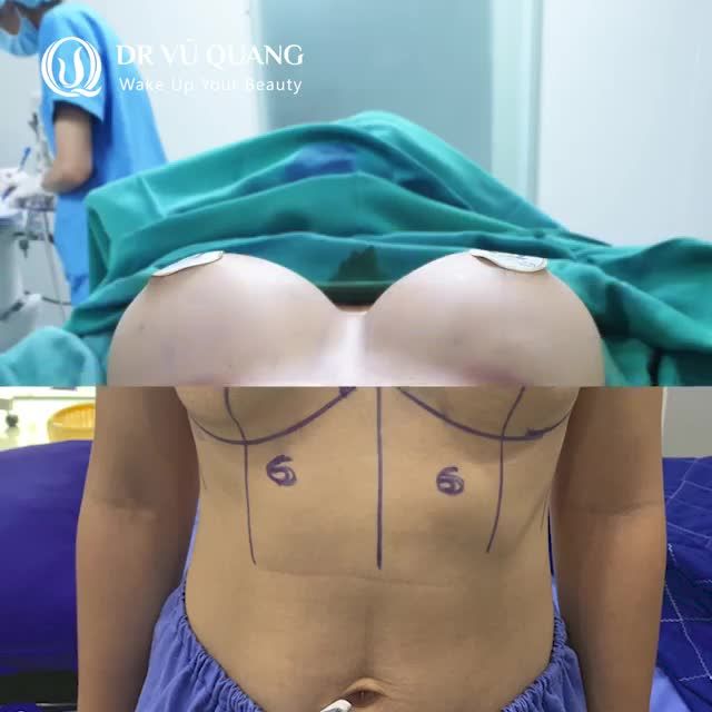 NÂNG V1 MENTOR - - HIỆU QUẢ, AN TOÀN