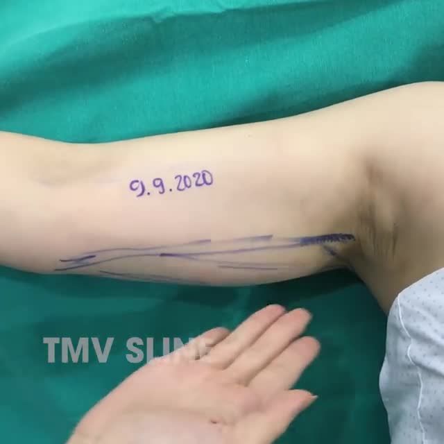 TẠM BIỆT CÔ BÉ ĐÔ CON GIỜ EM ĐÃ CÓ TAY THON DÁNG NGÀ