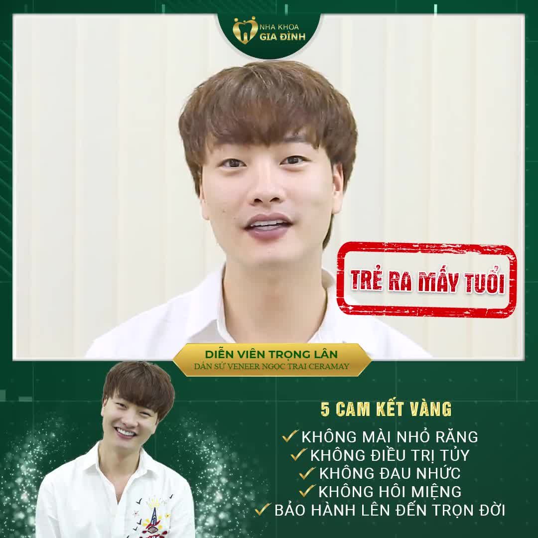CHỚP NGAY CƠ HỘI SỞ HỮU NỤ CƯỜI RẠNG NGỜI CHUẨN SAO