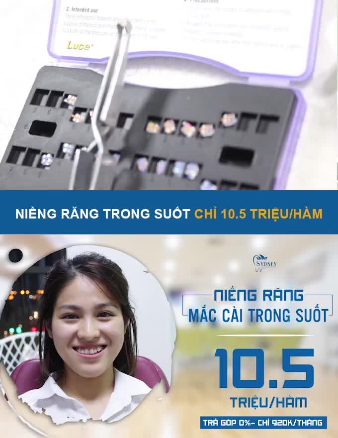 SO SÁNH NIỀNG RĂNG MẶT NGOÀI VÀ MẶT TRONG