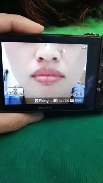 CA TẠO HÌNH MÔI TRÁI TIM SEXY VÀ GỢI CẢM SAU 30 PHÚT