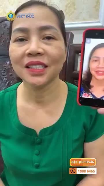 CHIÊM NGƯỠNG MÀN LỘT XÁC SAU PHỤC HÌNH 26 RĂNG SỨ NHIỄM MÀU TETRACYLINE