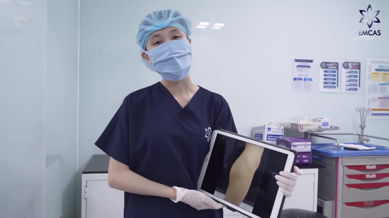 NÂNG MÔNG ĐỂ CHÂN DÀI HƠN - TẠI SAO KHÔNG