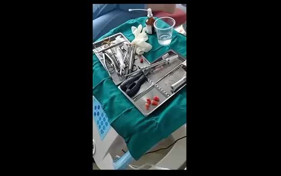 Nhổ 4 răng khôn một lúc tại NK ATHENA