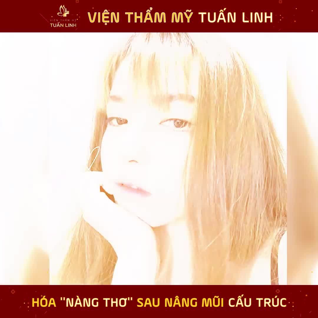 Khách hàng nhà Tuấn Linh bỗng hóa "nàng thơ" sau nâng mũi. - Đó hoàn toàn là sự thật... Diện mạo của bạn trước và sau hoàn toàn khác nhau.