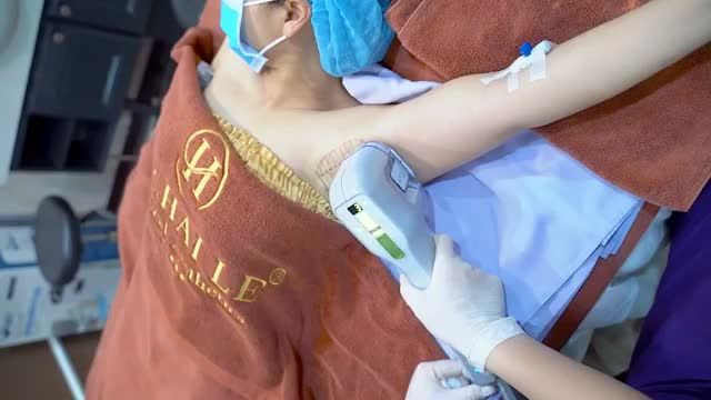 Bạn đang gặp phải vấn đề mùi hôi ẩm ướt, tăng tiết mồ hôi khó chịu? thì không thể bỏ qua video điều trị triệt để hôi nách và tăng tiết mồ hôi miraDry