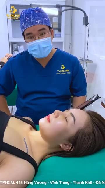 khách hàng tái khám sau 10 ngày nâng mũi