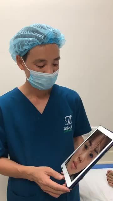 CẮT MÍ TRÊN - NÂNG MŨI S-Line - THU MỎNG TẠO HÌNH MÔI