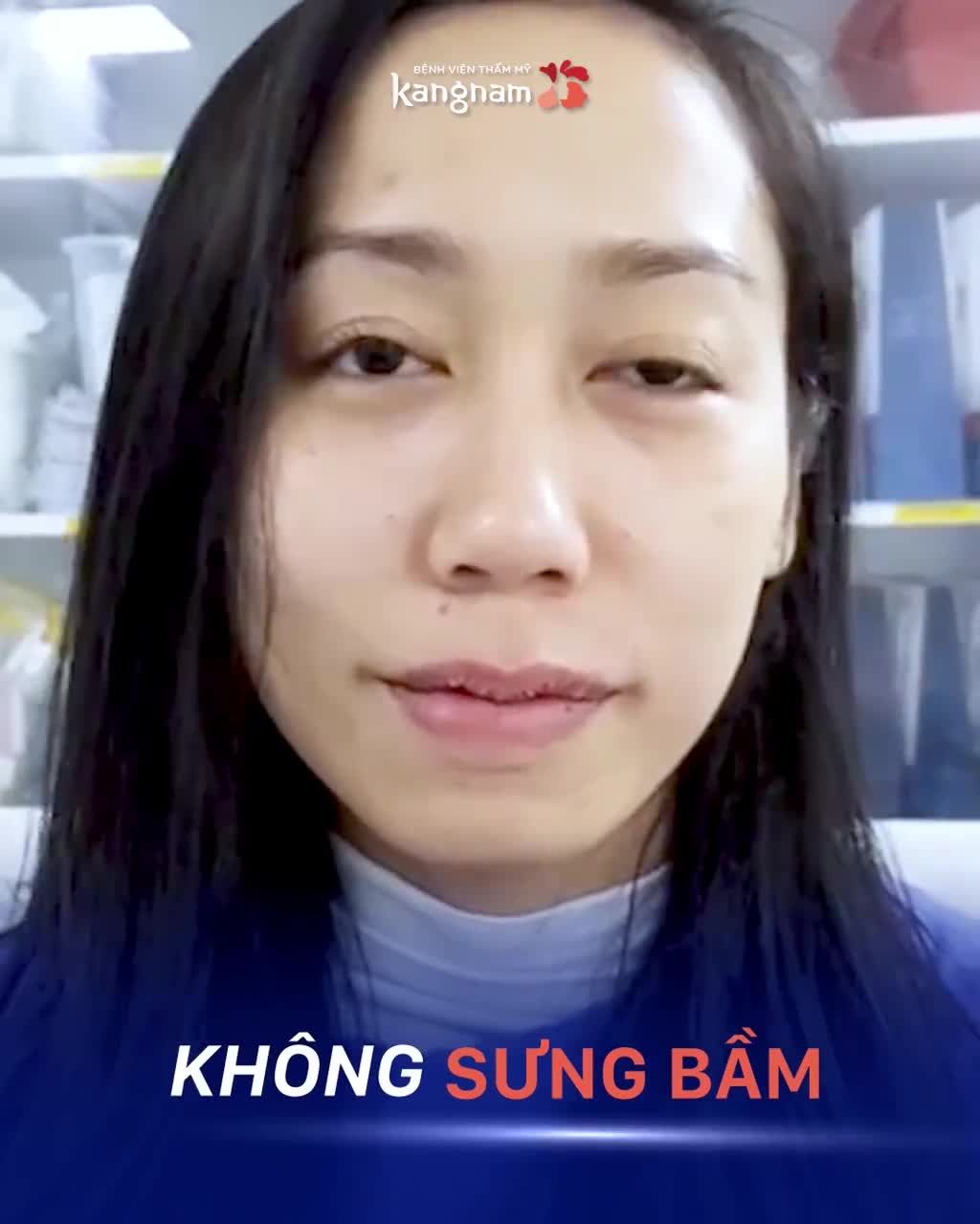 Đừng để ĐÔI MÔI KHÔNG XINH làm Mặt KÉM HÀI HÒA!