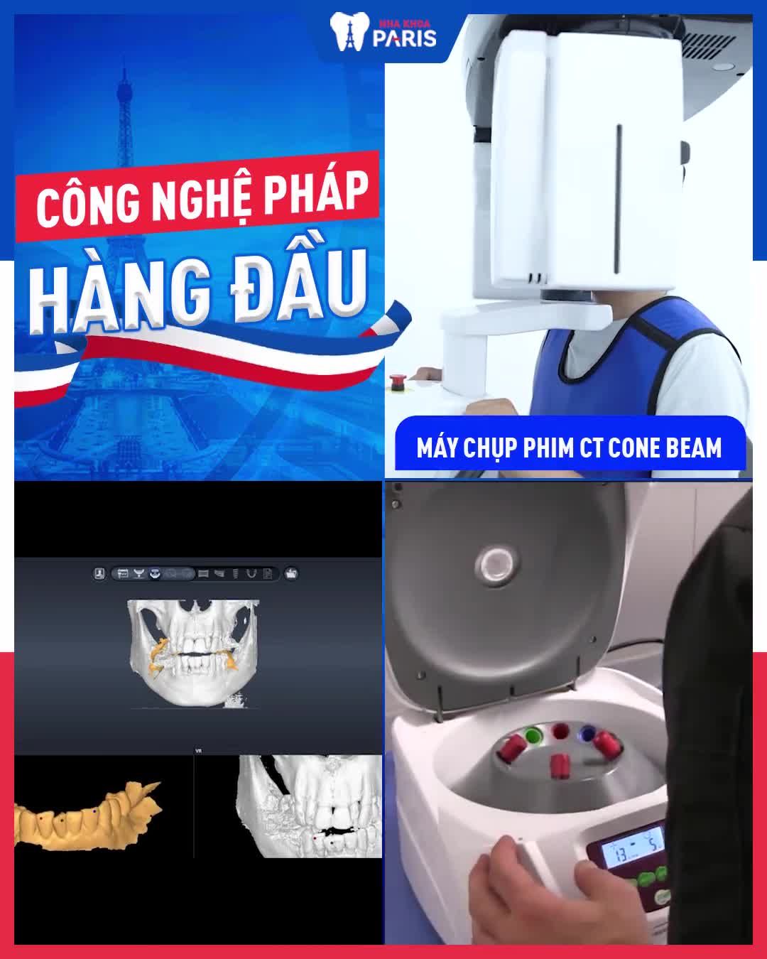Bùng nổ ưu đãi  Trồng răng 12.8 triệu - Tặng quà 10 triệu