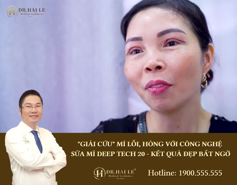 Chị gái TRÓT LỠ cắt mí hỏng tại cơ sở kém uy tín và Hành trình "GIẢI CỨU" đôi mắt hoàn hảo tại Dr.Hải Lê‼️