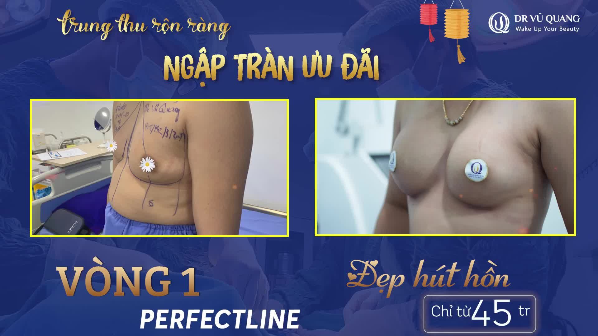 TRUNG THU RỘN RÀNG - NGẬP TRÀN ƯU ĐÃI  nâng Ngực trọn gói chỉ từ 45 Tặng
