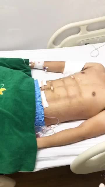 Bệnh viện quay quá trình thay băng bụng 6 múi tại bệnh viện